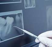Dentist using tool to point to patient's X-ray
