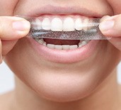 Closeup of patient putting on a whitening strip