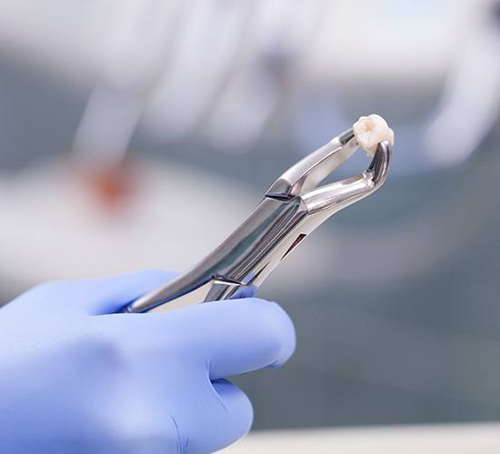 extracted tooth in metal clamp