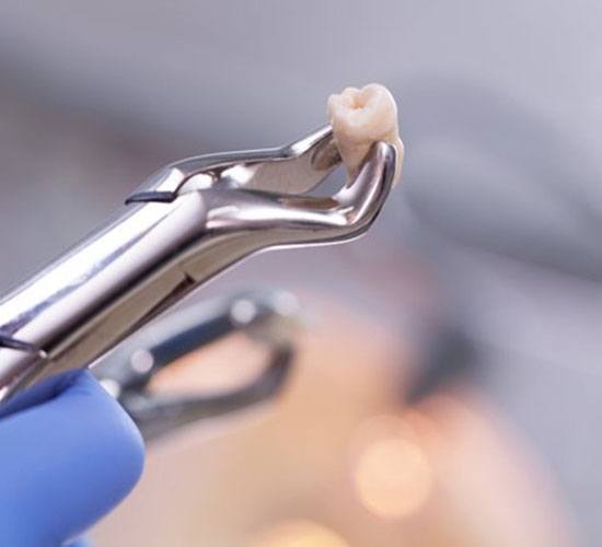dentist holding an extracted tooth with a dental instrument 