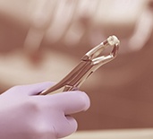 a close-up of forceps holding an extracted tooth 