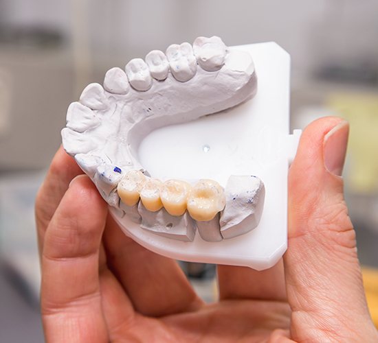 Rockledge Dental bridge mockup