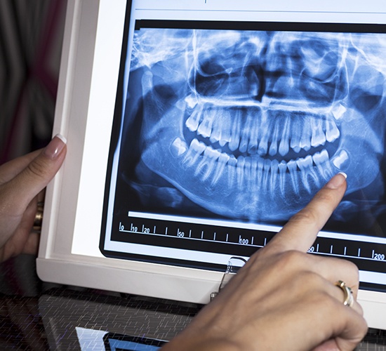 Digital X-ray on tablet