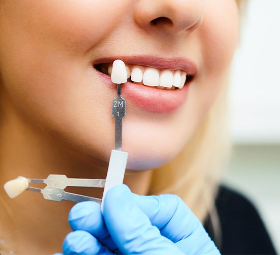 woman with veneer shade in front of tooth